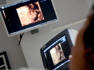monitor de embarazo