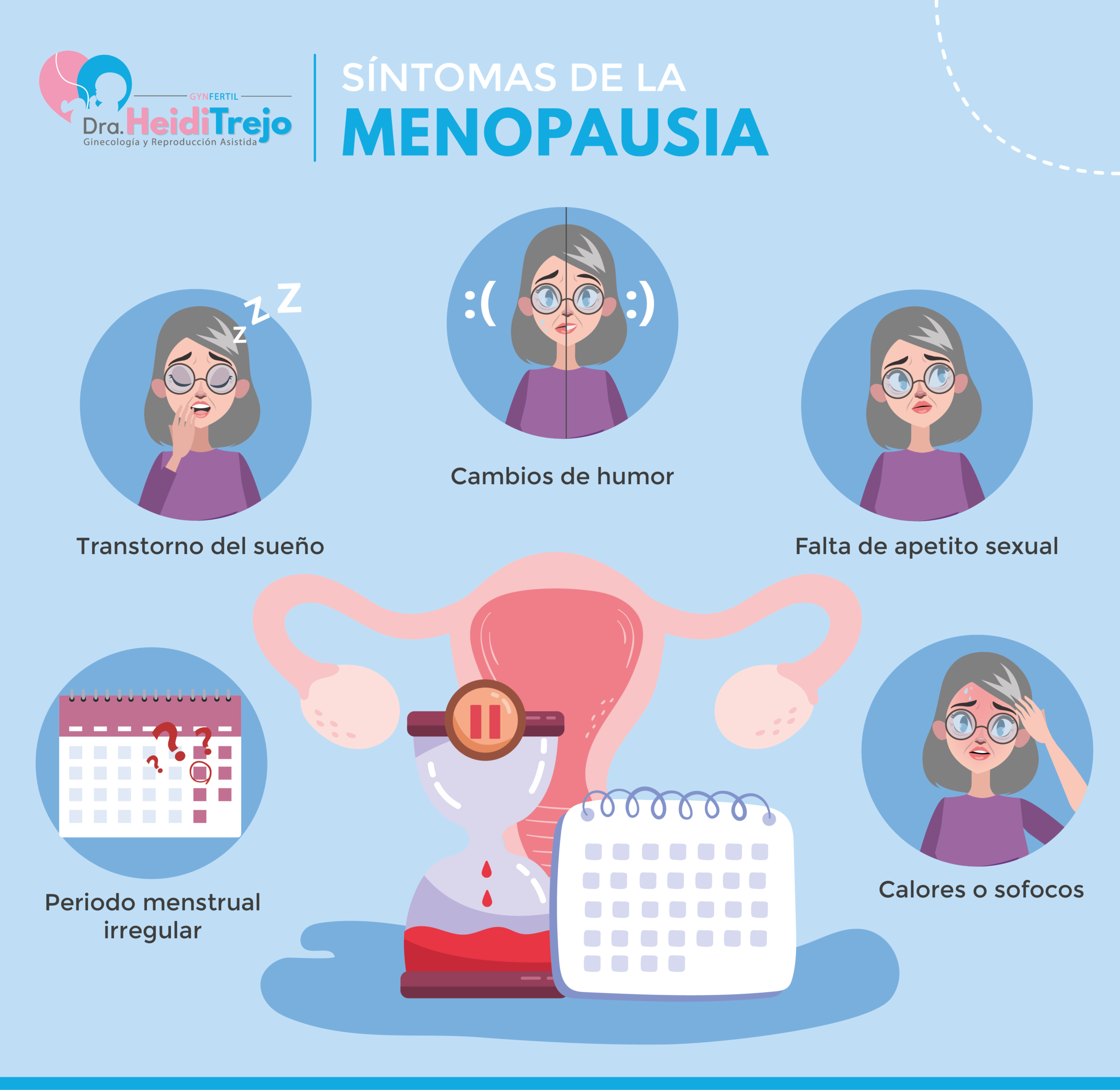 Infografia de síntomas de la menopausia precoz