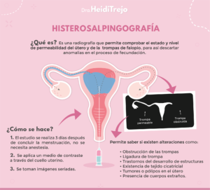 estudio de histerosalpingografía