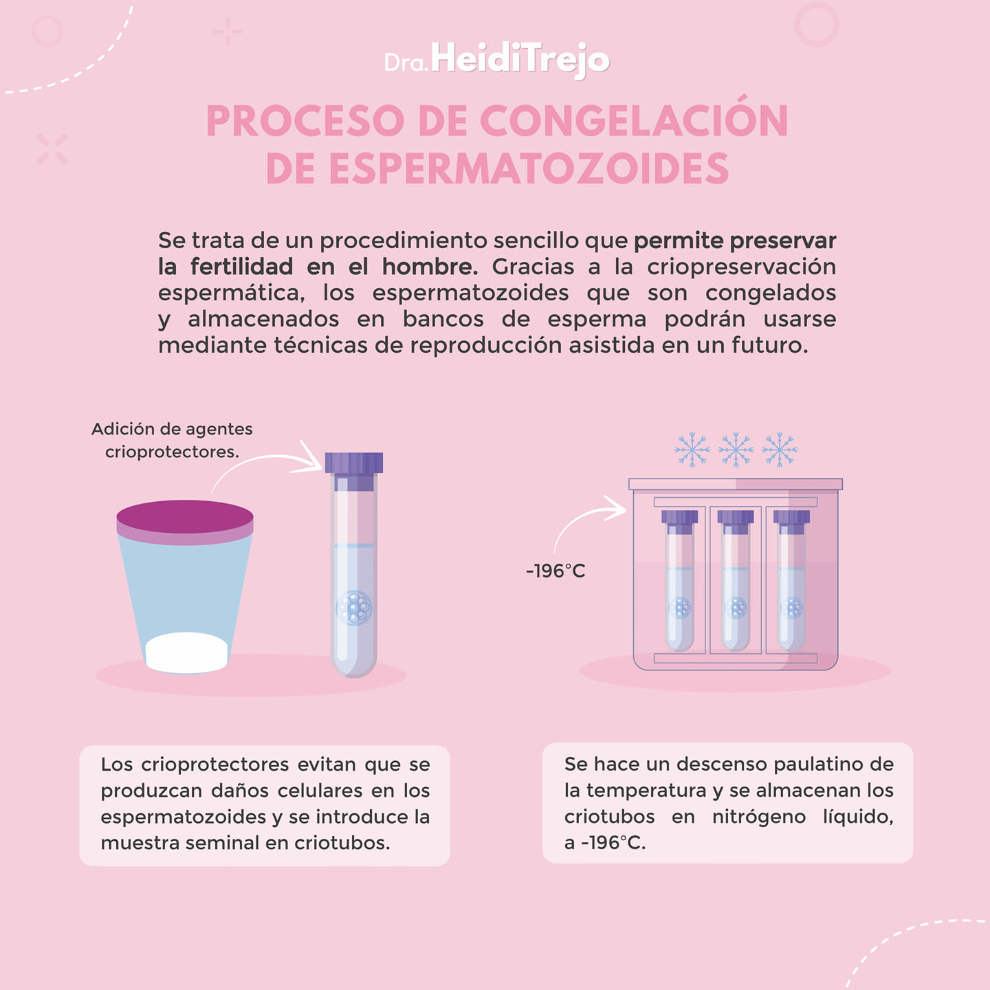 congelacion de espermatozoides